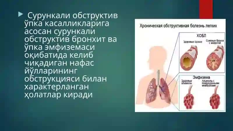 Сурункали обструктив ўпка касалликлари 3