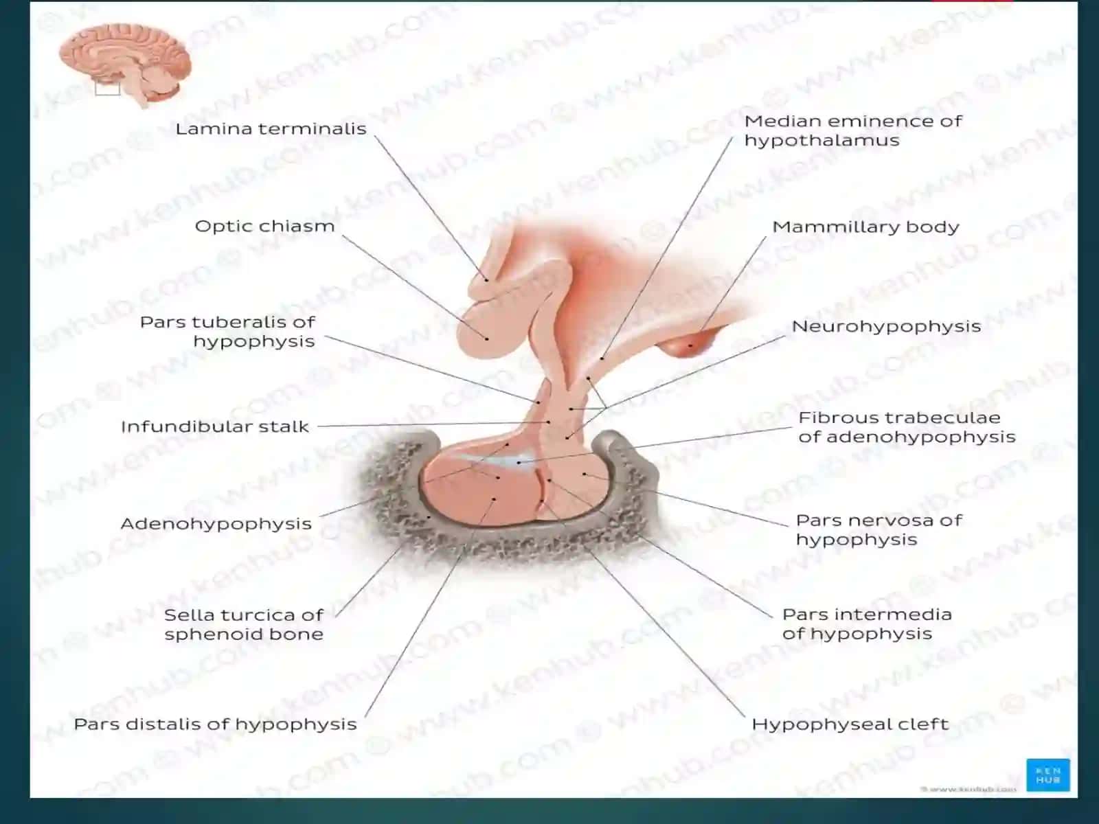Hypothalamus 3