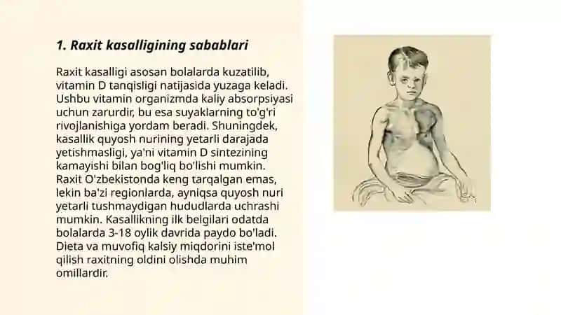 Raxit kasalligi 3