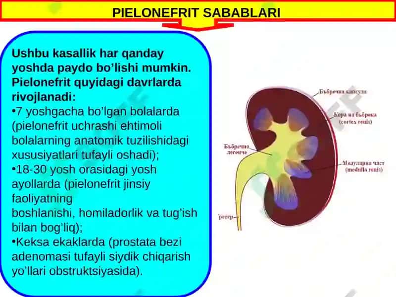 PIELONEFRIT 3