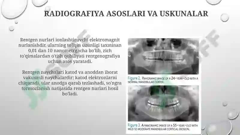 Radiografiya asoslari va texnikasi 3