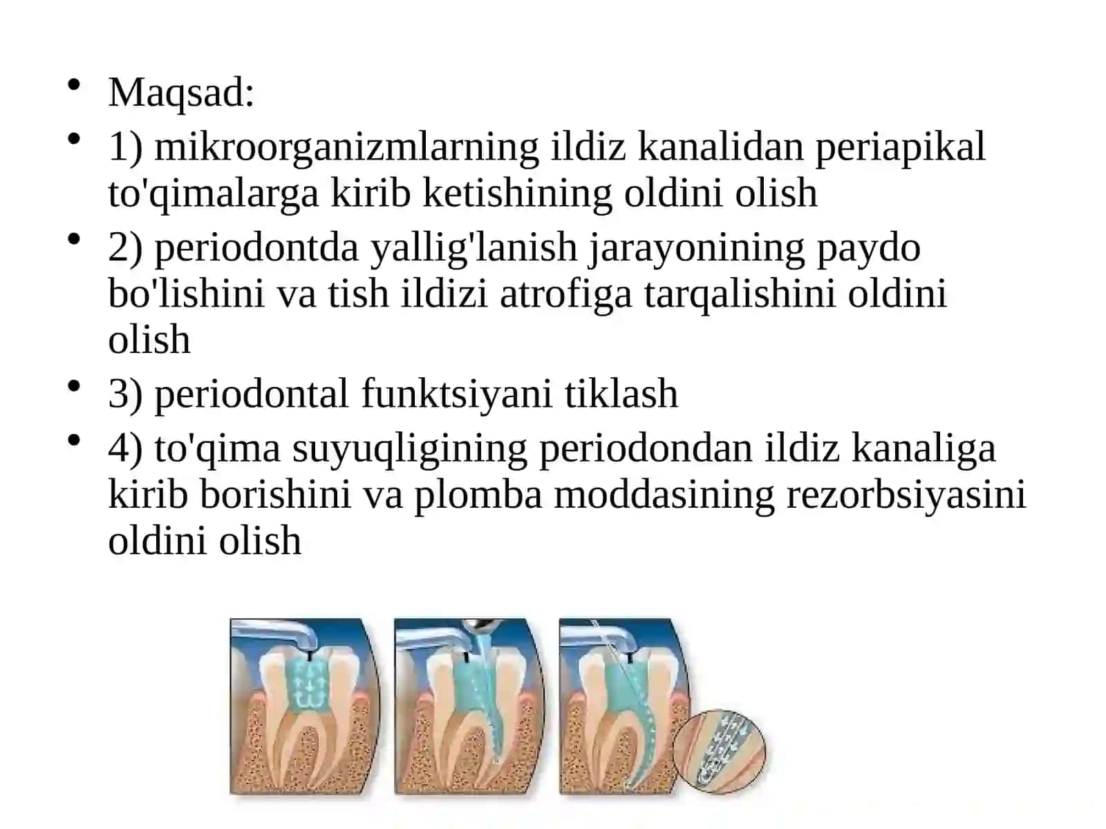 Ildiz kanalini plombalash 3