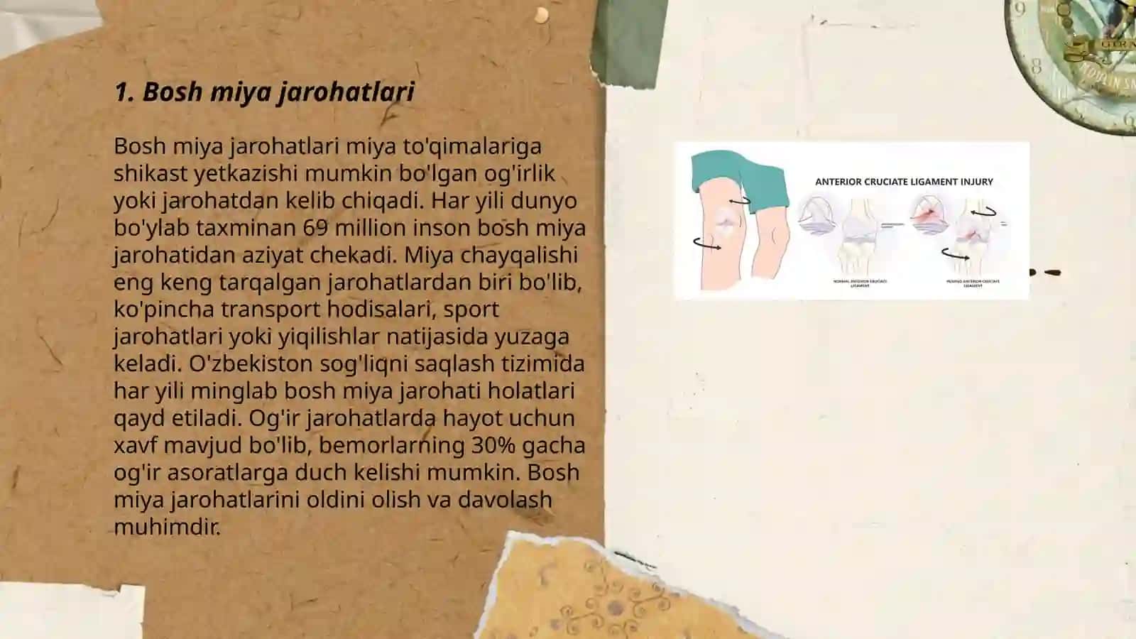 Bosh miya jarohatlari 3