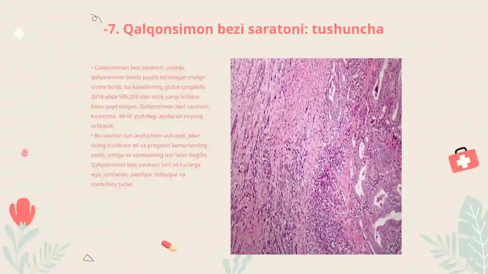 Qalqonsimon bezi saratoni 3