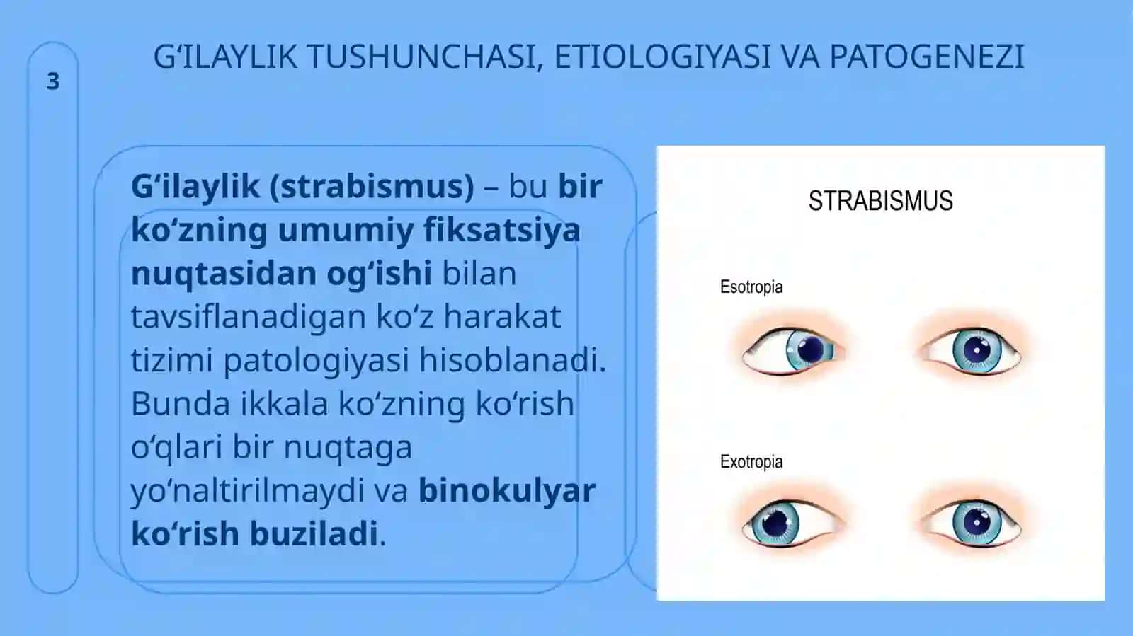 GʻILAYLIK (STRABISMUS) 3