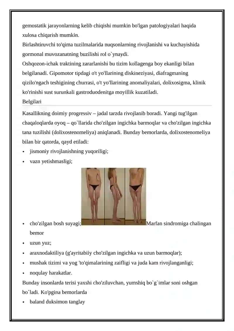 MARFAN SINDROMI 3