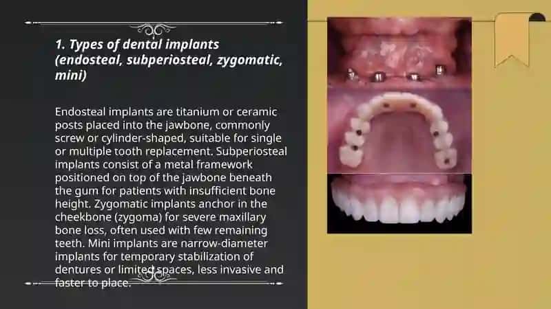 Dental Implants 3