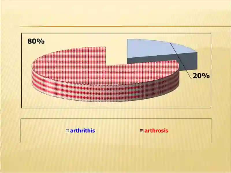Articular syndrome 4