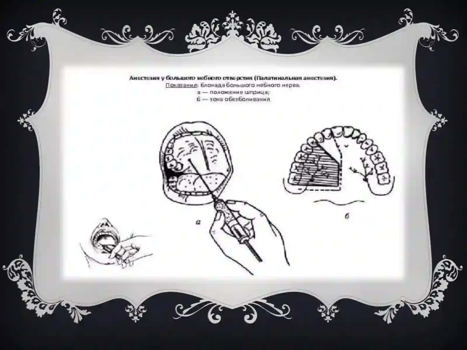 PALATINAL OG’RIQSIZLANTIRISH 4