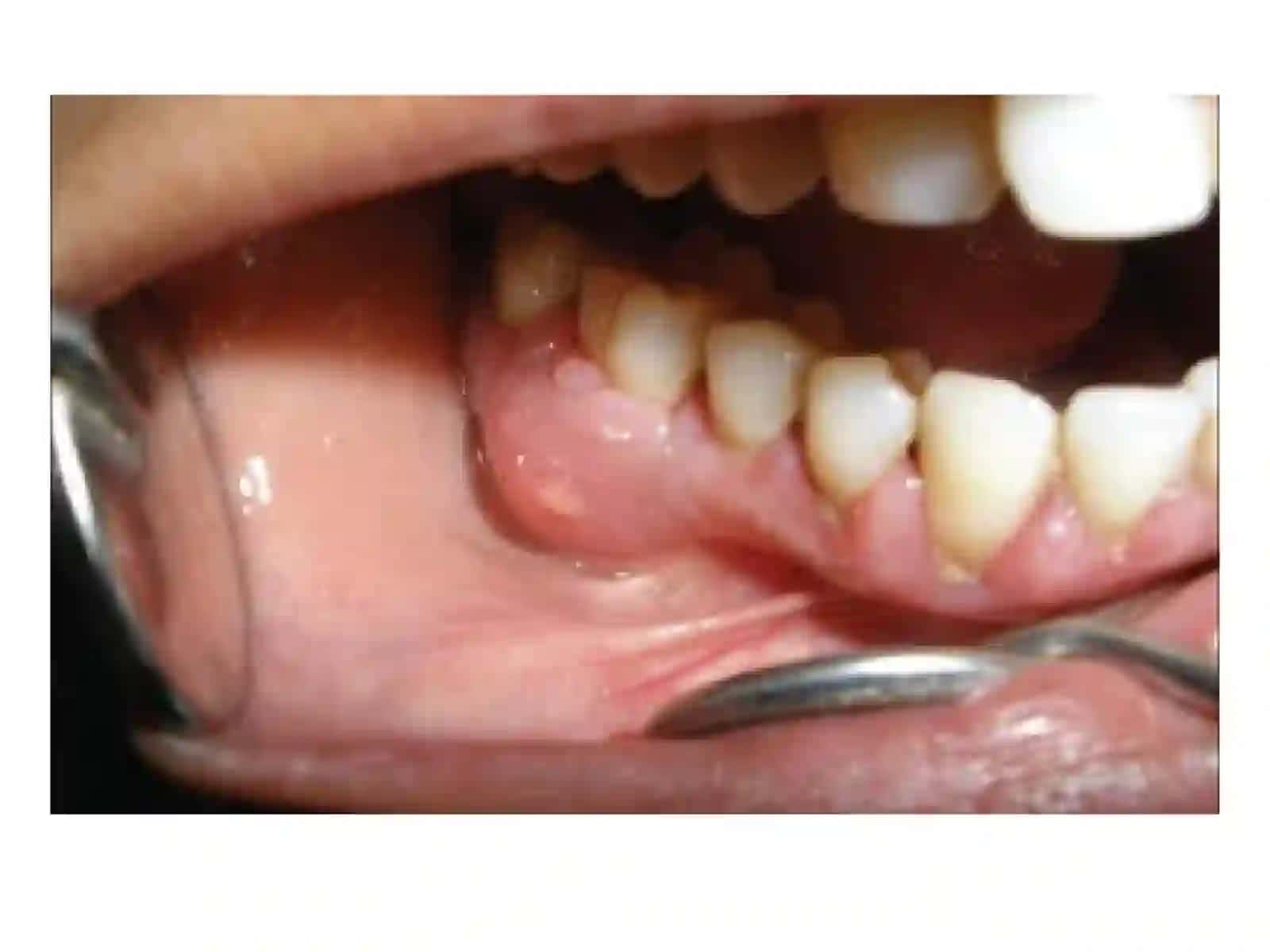 Klinik endodontiya 4