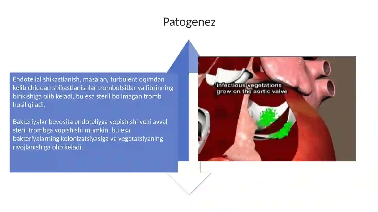 infeksion endokardit 4