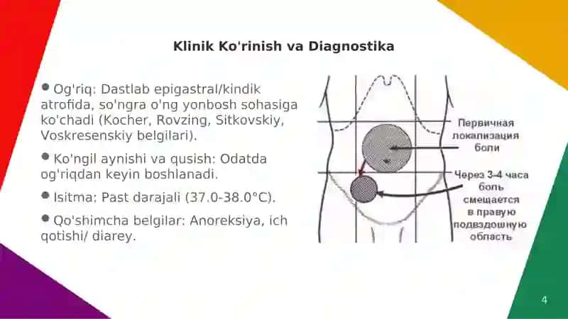 O'tkir appenditsit 4