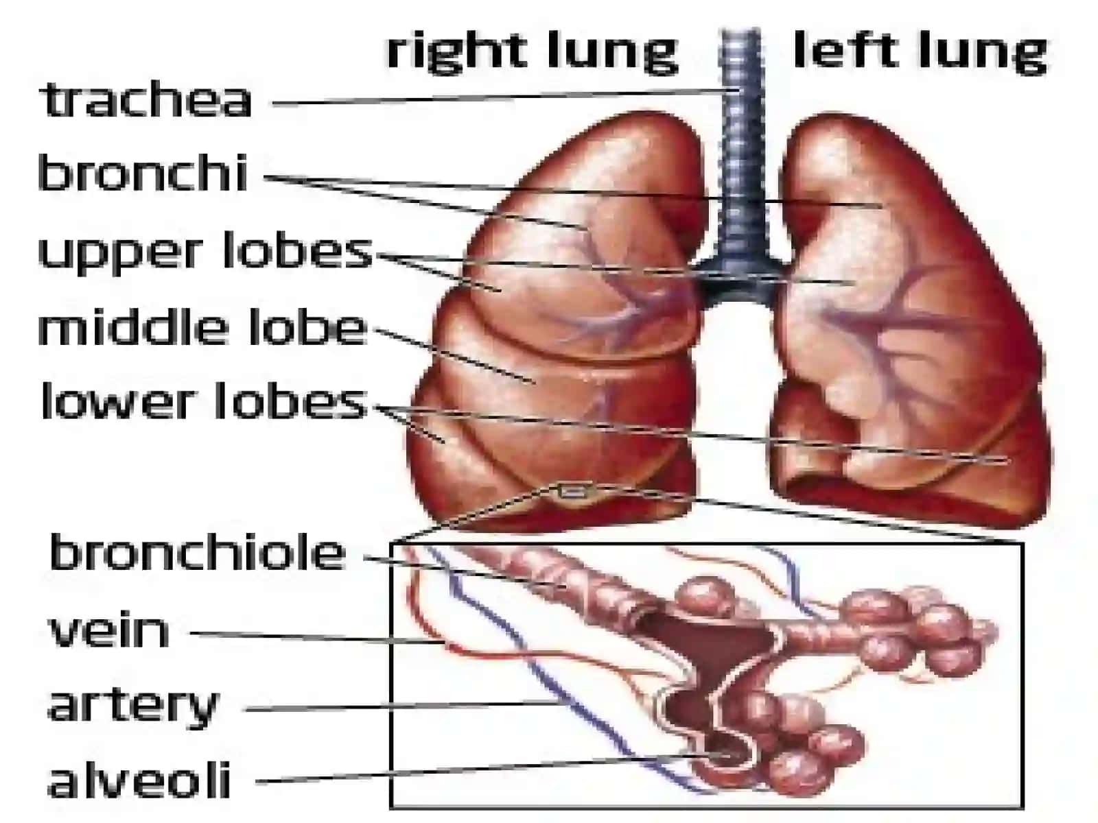 Pnevmoniya (Pneumoniya) 4