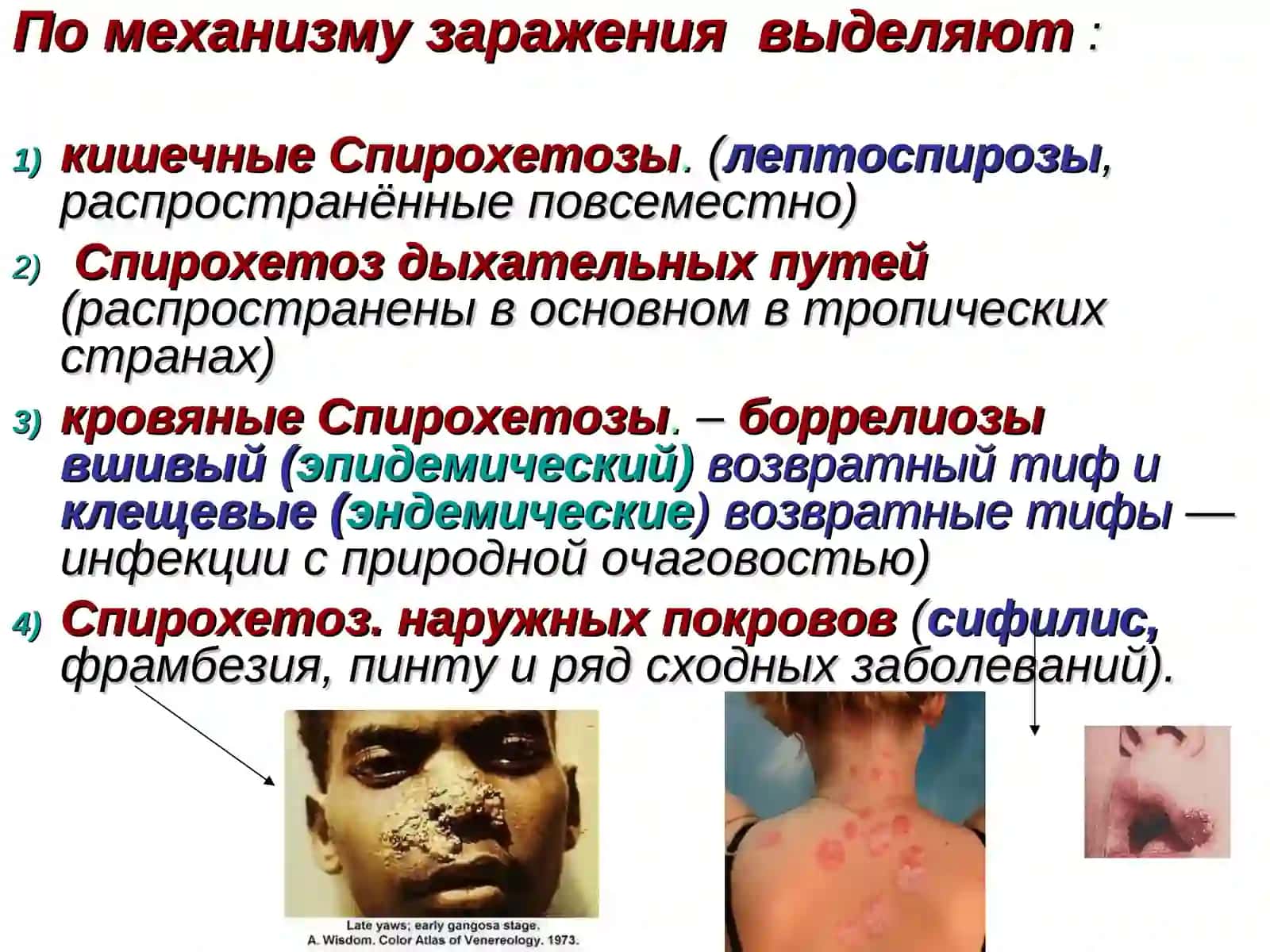 Спирохетозы 4