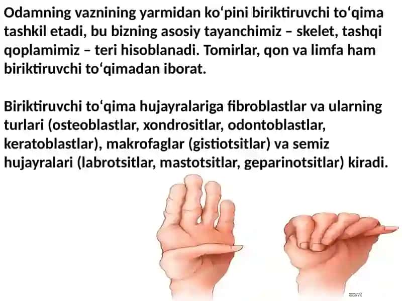 Marfan sindromi 4