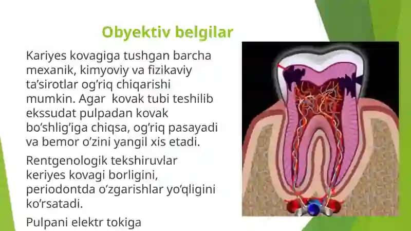 O'tkir diffuz pulpit 4