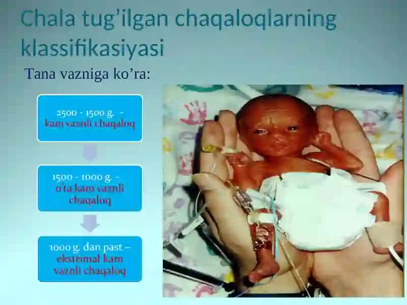 Chala tug’ilgan chaqaloqlar 4