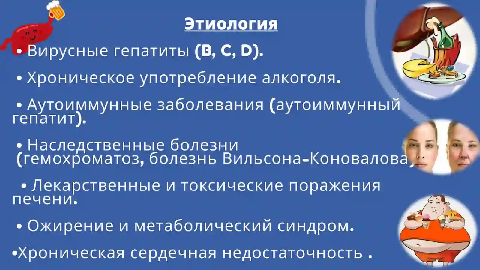 Цирроз печени 4
