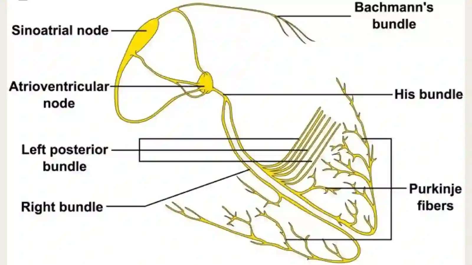 Yurak ritmining buzilishilari 4