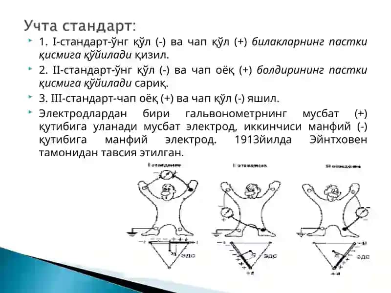Elektrokardiogramma 4