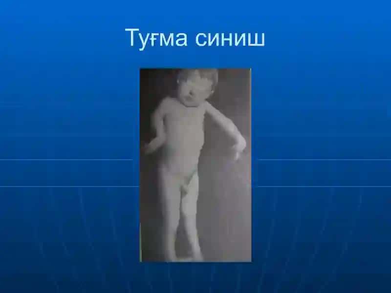 Суякларнинг синиши ва чикиши. 4