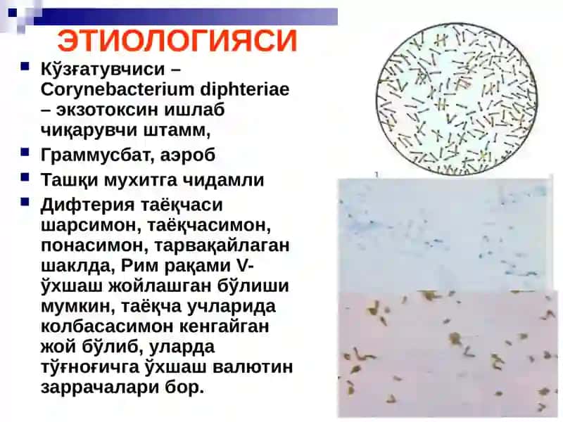 difteriya 4