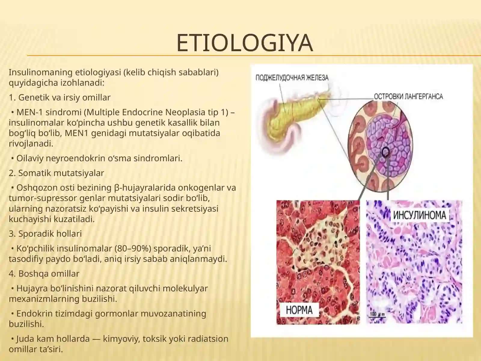 Insulinoma 4