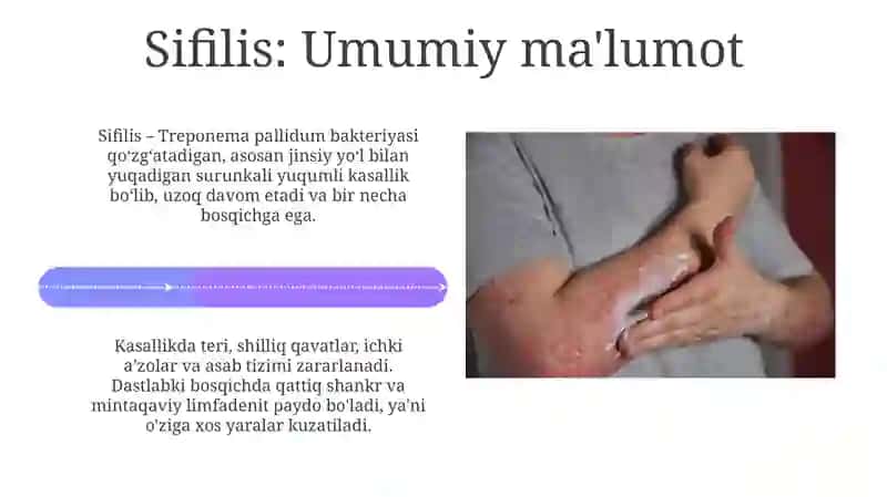 Sifilis va OIV/OITS 4