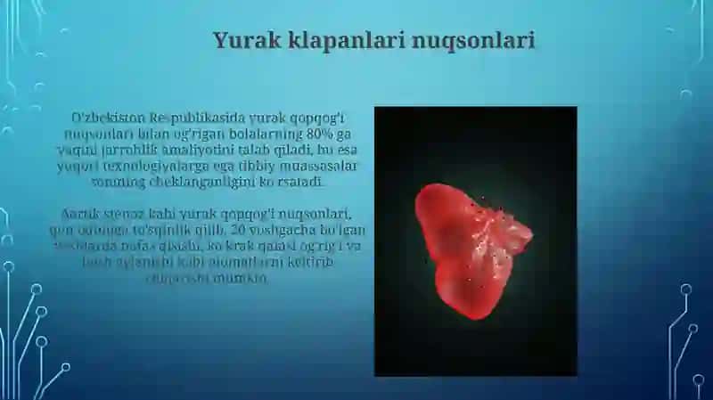Fallot tetralogiyasi 4