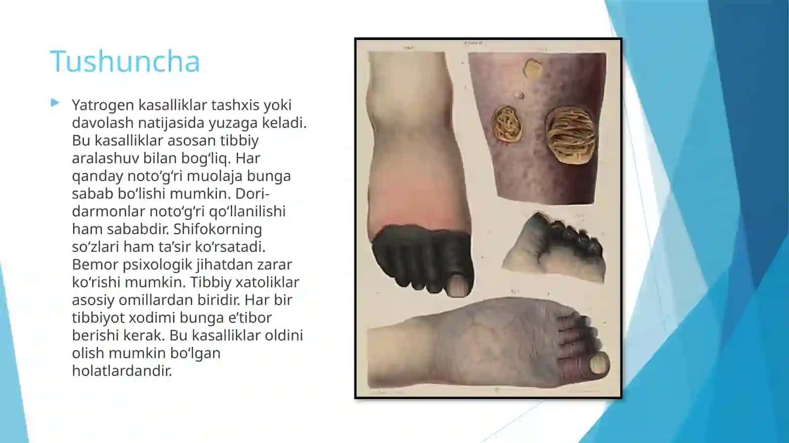 yatrogen kasalliklar 4