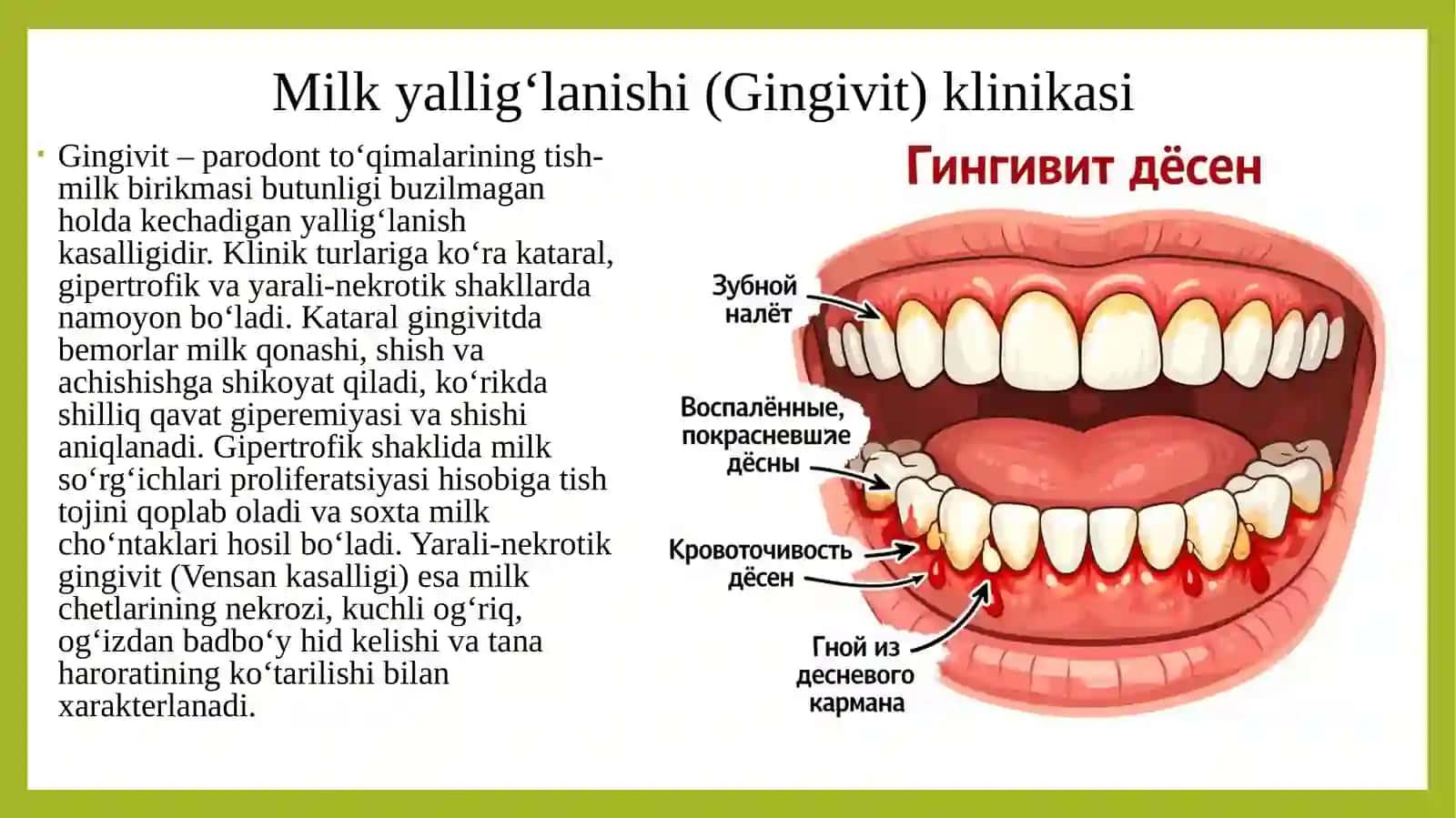 Ogʻizboʻshligʻi va paradont kasalliklari 4