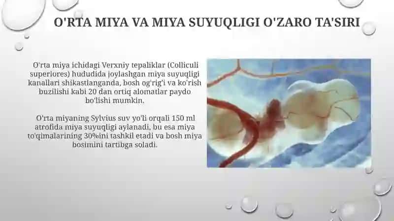 Choroid pleksuslar 4