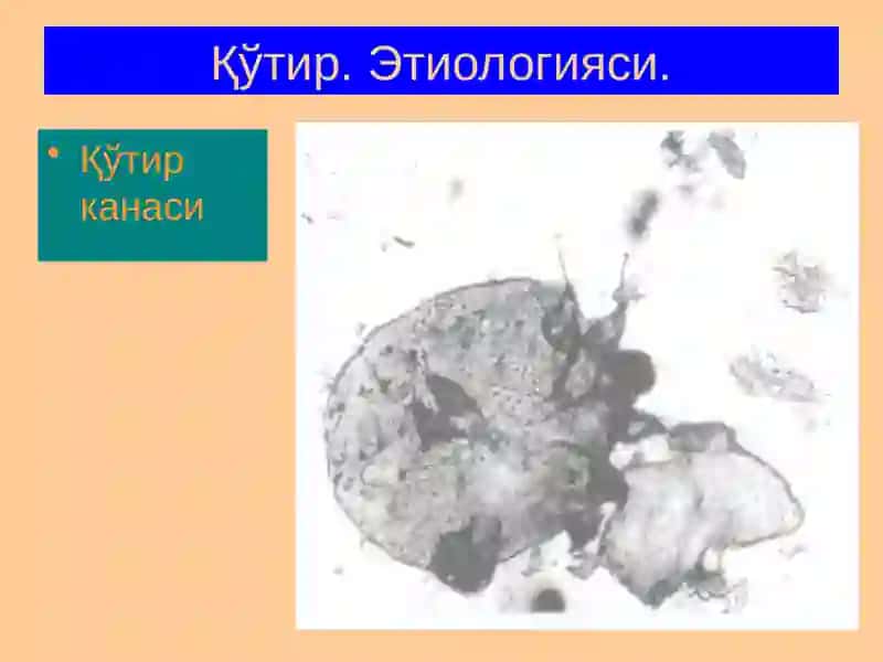 Терининг паразитар касалликлари 4