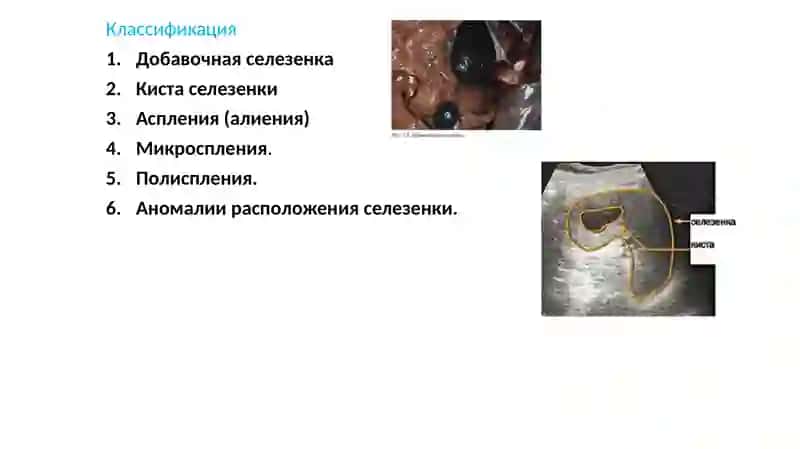 Аномалии развития селезенки – это стойкие изменения морфологической структуры органа, возникающие 4
