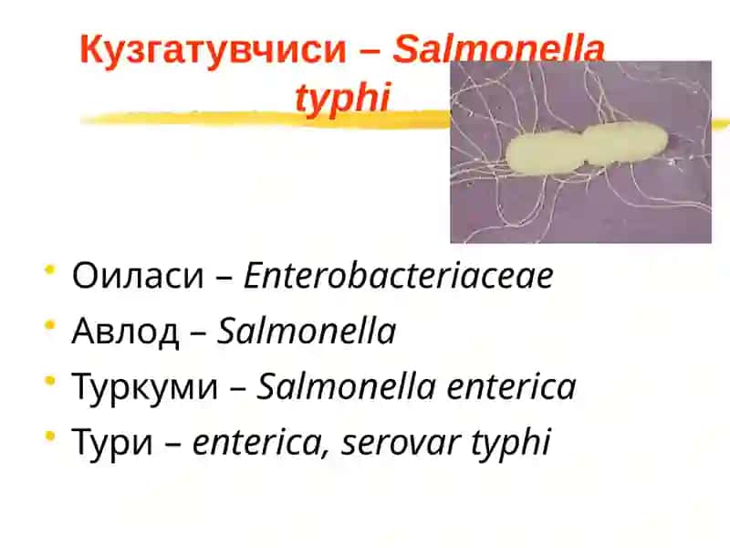 Ич терлама – қорин тифи (typhus abdominalis) 4