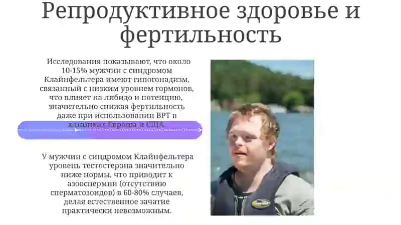 Синдром клайнфельтера 4