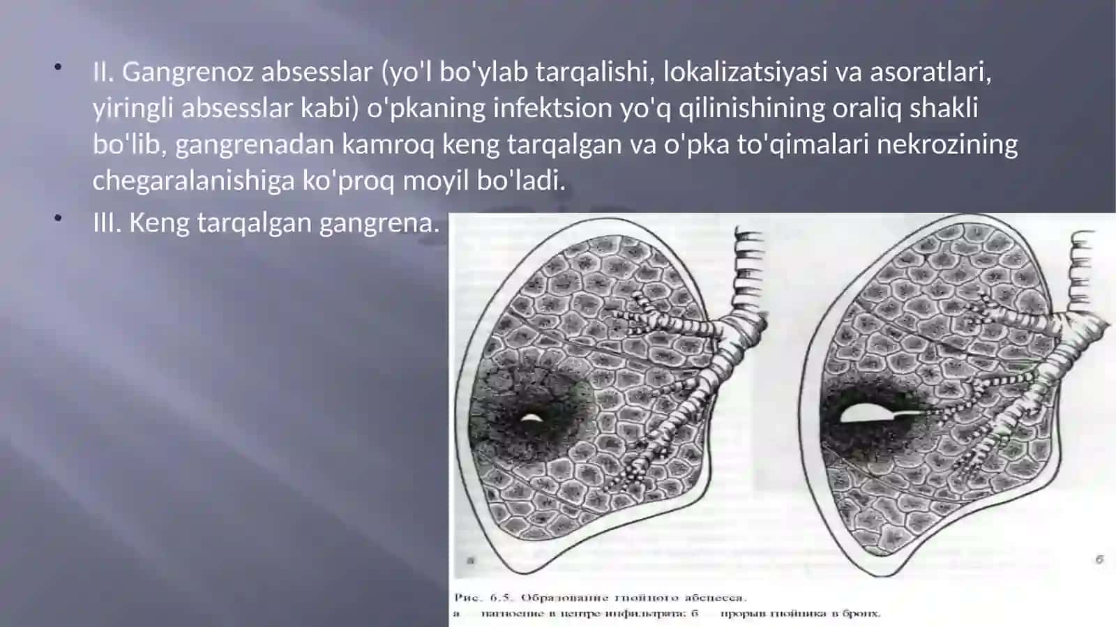 O'PKA ABSESSI TASNIFI 4