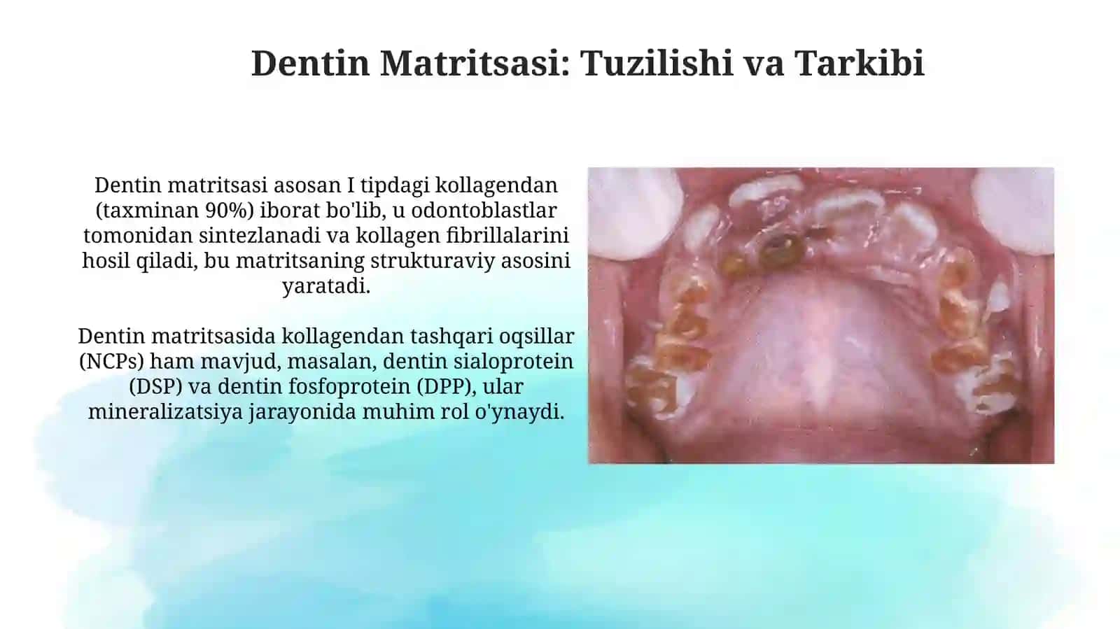 Dentinogenez 4