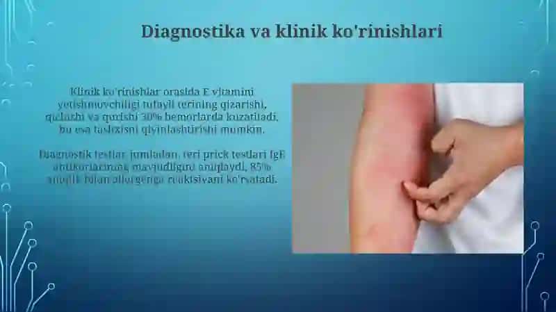 Terining allergik kasalliklari 4
