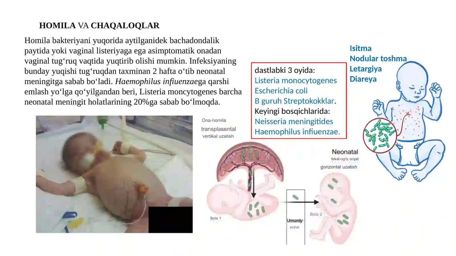 Listeria 4