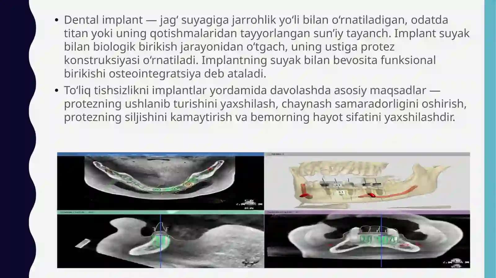 Implantatsiya usullari 4