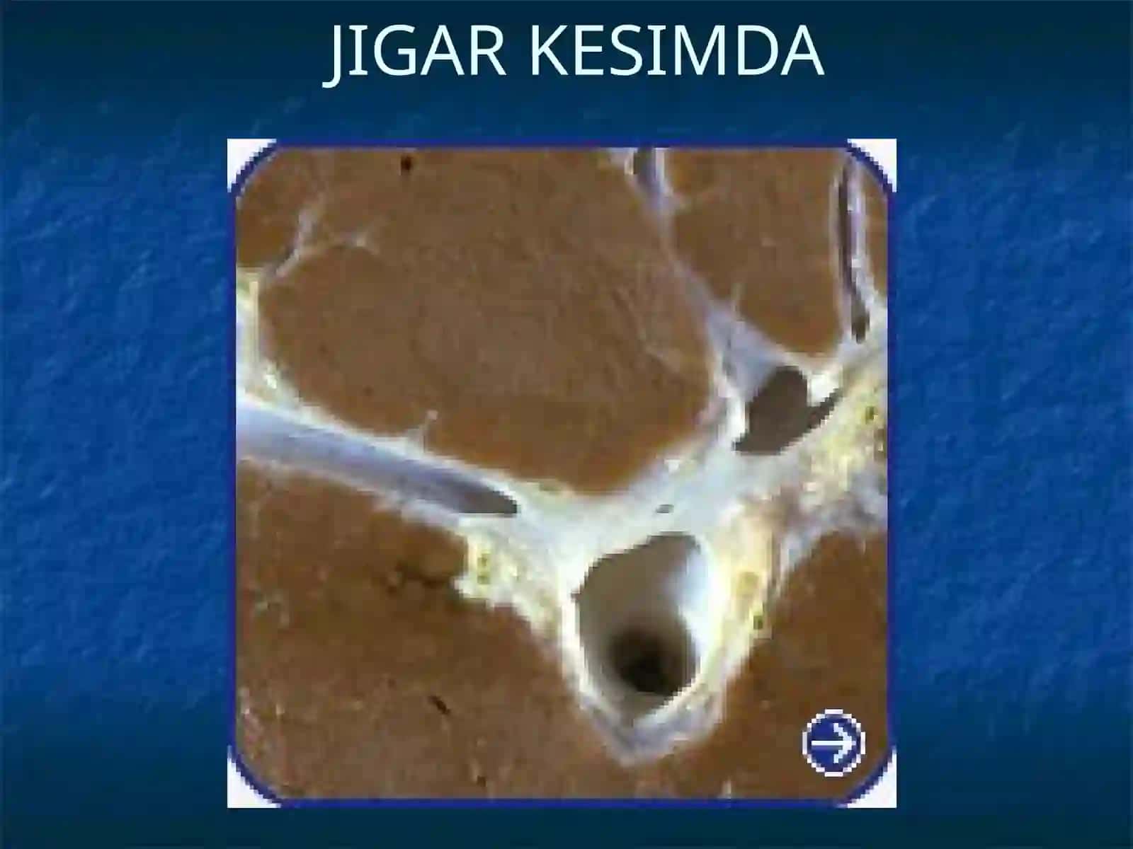 JIGARSIRROZI 4