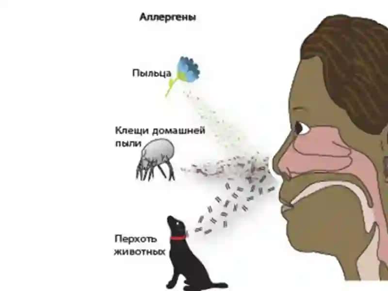 Аллергик ринит 4