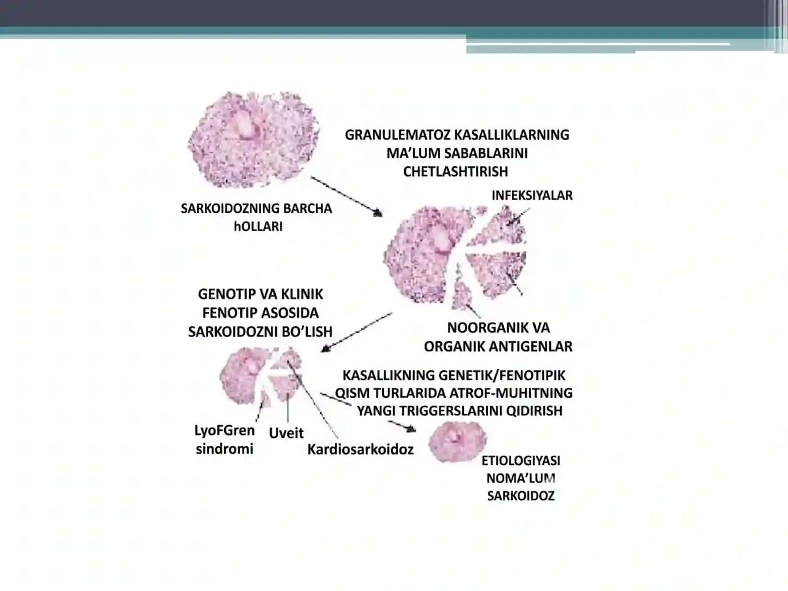 Sarkoidoz 4
