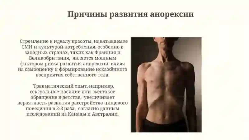 Анорексия 4