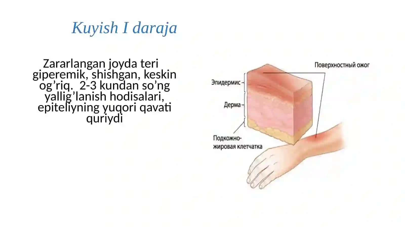 Kuyish kasalli 4