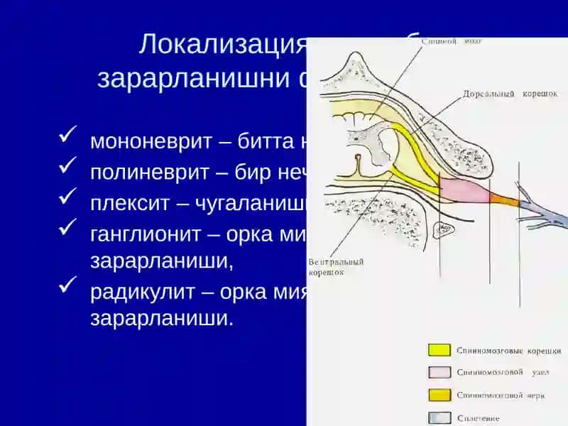 НЕРВ СИСТЕМАСИНИНГ ПЕРИФЕРИК КАСАЛЛИКЛАРИ 4