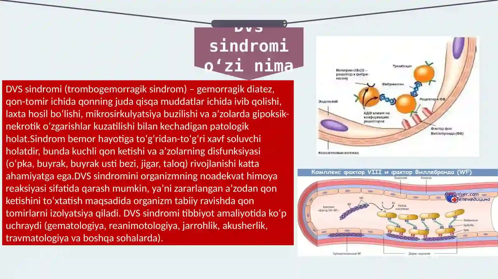 DVS sindromi 4