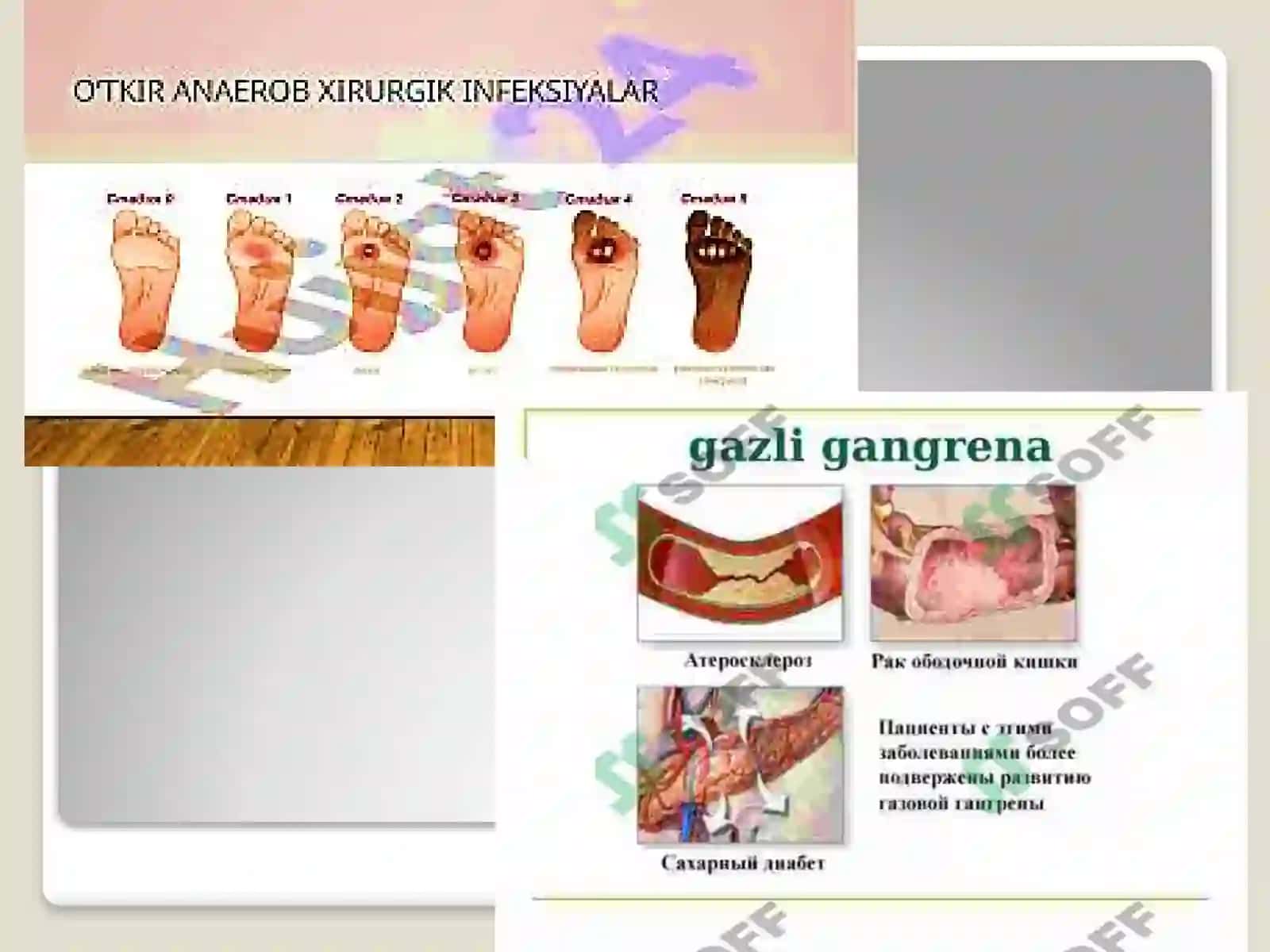 O'tkiranaerob infeksiyalar 4