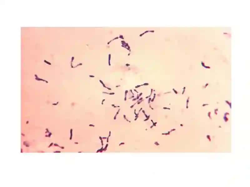 Corynebacterium diphtheriae 4